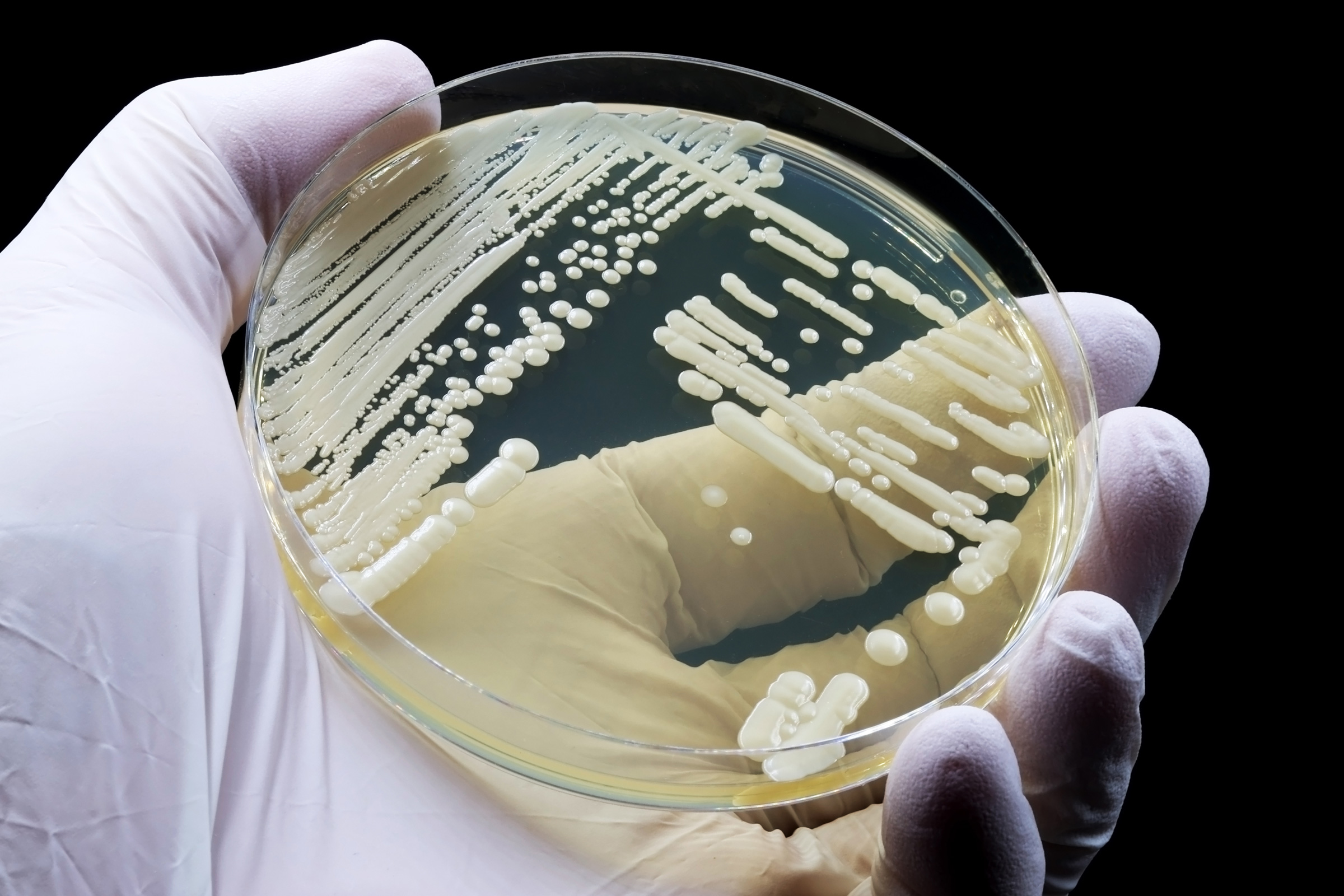 Candida Auris Cases Are on the Rise. How Can Infection Prevention